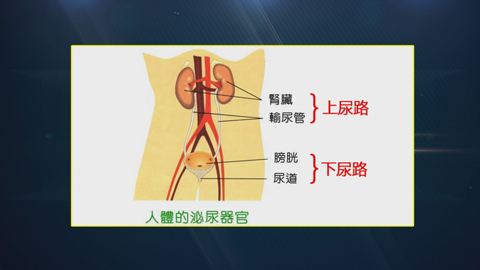 尿路感染