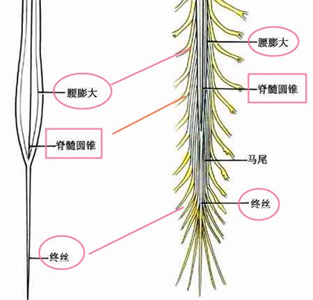 马尾神经综合症