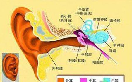 胆脂瘤型中耳炎