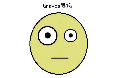 Graves眼病